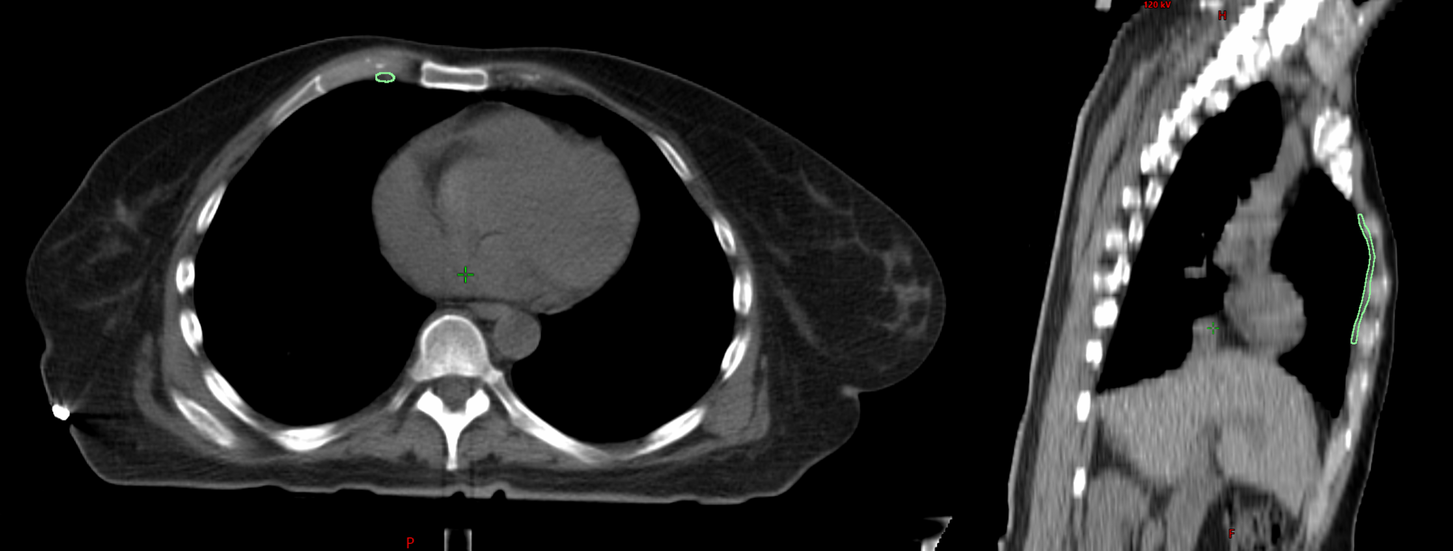 Good IMN Contour Example